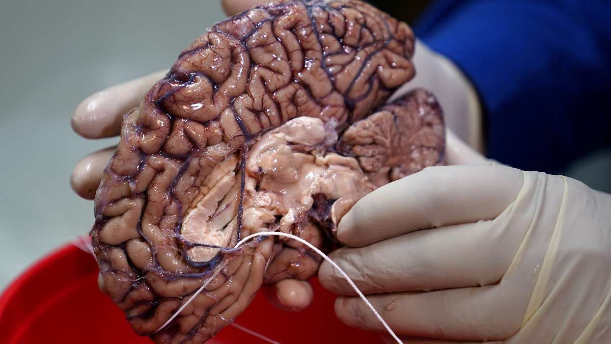 Remaining silent for three days can Improve brain health says new study